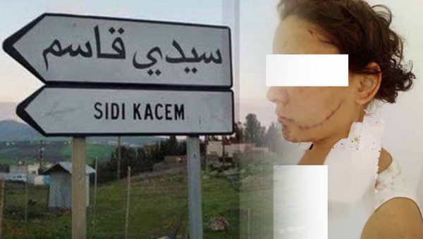 بعد سارة: زوج يغتصب زوجته ويُشرملها بسيدي قاسم
