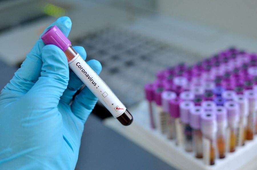 Coronavirus concept with blood vial jarun011 Getty Images