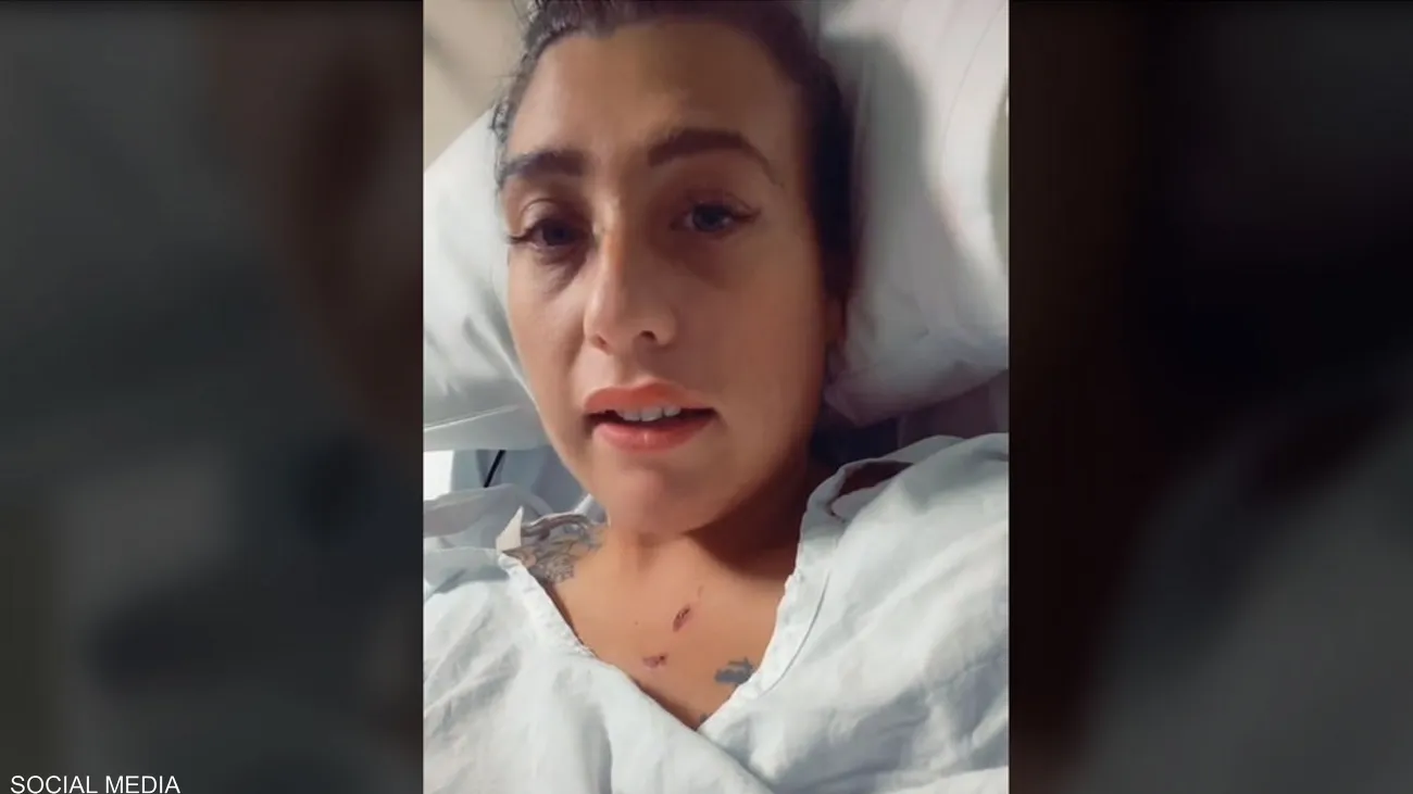 بعد عملية تجميل.. شابة تصاب بعدوى خطيرة نادرة