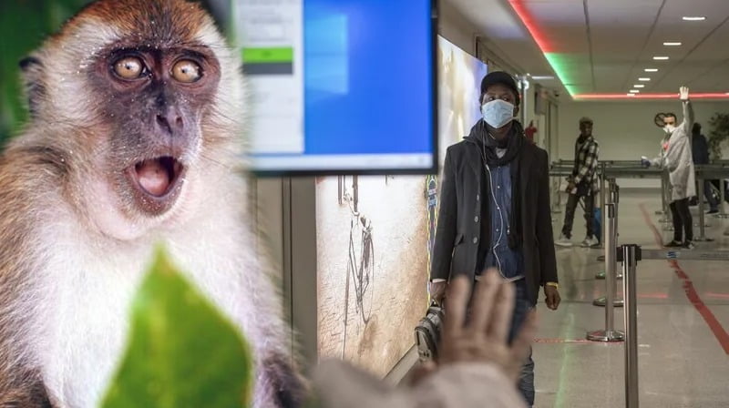 آخر التطورات الحالة الصحية للأشخاص المشتبه في إصابتهم ب جدري القردة