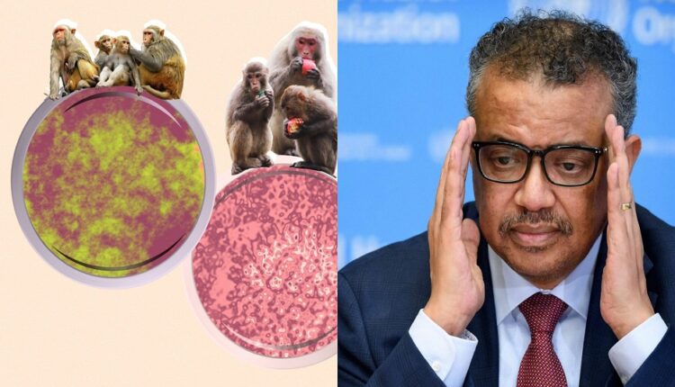 منظمة الصحة العالمية تعلن عن حصيلة ضحايا جدري القرود