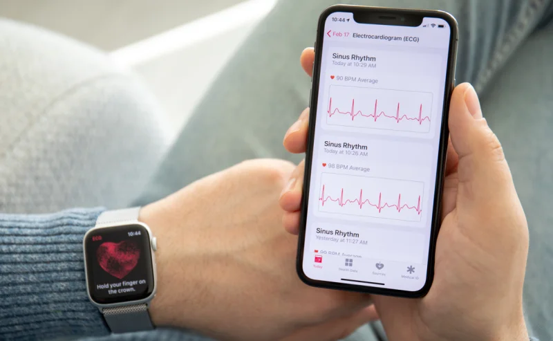 آبل تخطط لإضافة ميزات جديدة لساعاتها الذكية في عام 2024