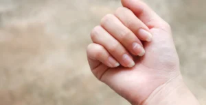 ظهور بقع بيضاء على الأظافر: الأسباب والعلاج