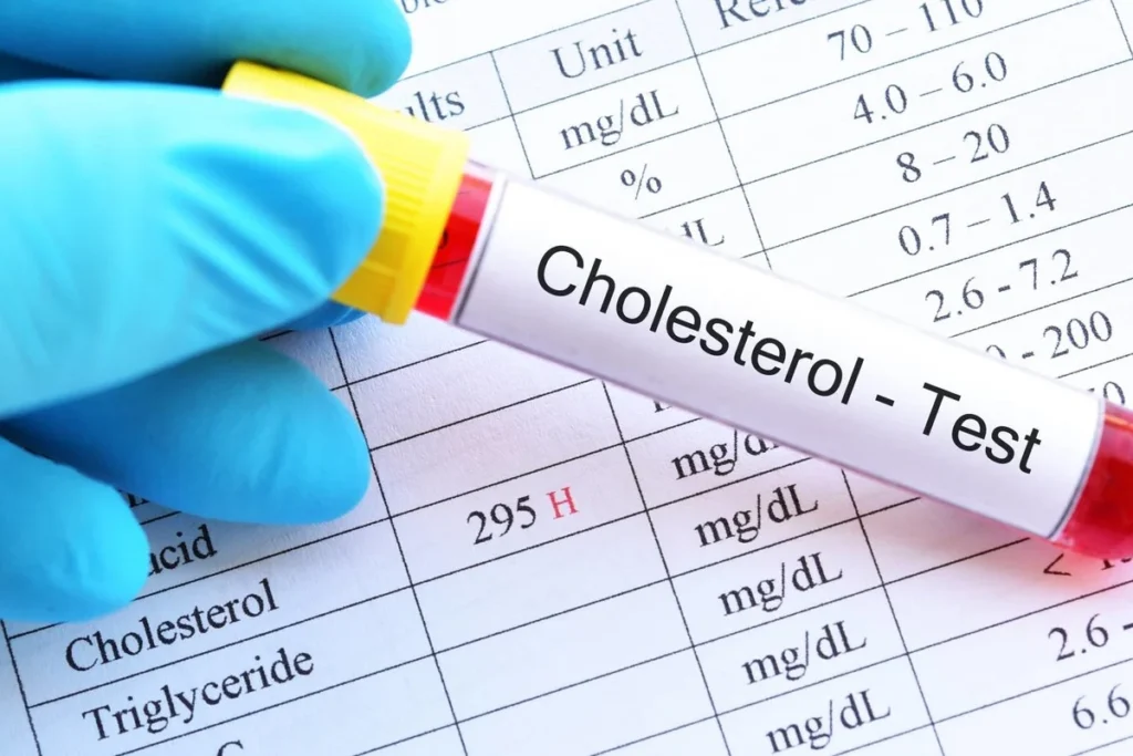 الكشف المبكر عن ارتفاع الكوليسترول