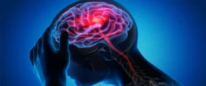 انتبه لهذه العلامات: أعراض غير نمطية للجلطة الدماغية قد لا تعرفها